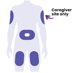 Image shows approved injection areas, stomach area (abdomen), the front of the thighs, or back of the upper arms for care partner injections